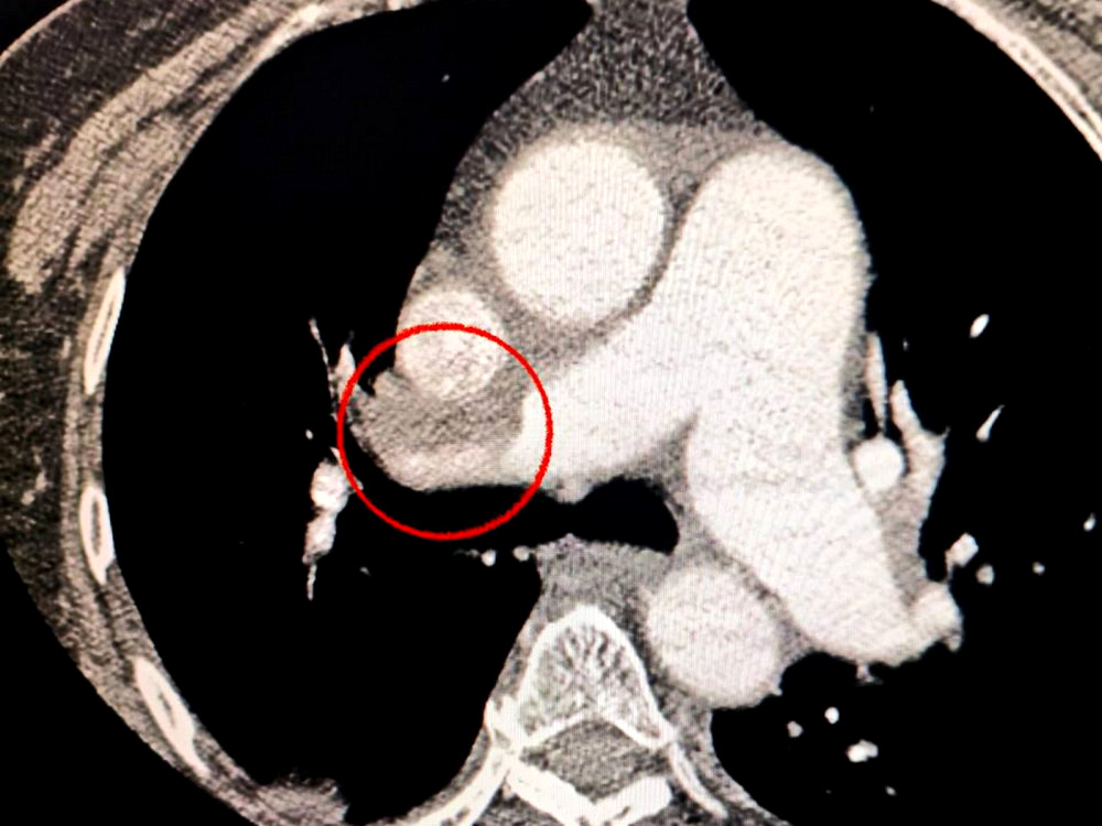 9884 image for slide